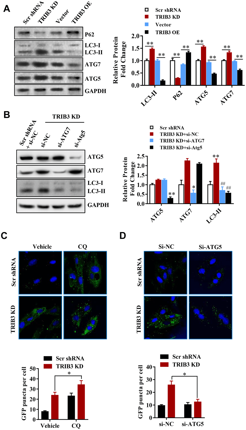 TRIB3 knockdown induces autophagy flux in GBM cells. (A) Western blot analysis to detect the protein levels of P62, LC3, ATG5, ATG7, and GAPDH (control for loading) in U251 cells treated with Ad-Scr, Ad-siTRIB3, Ad-vector, and Ad-TRIB3 for 48 h. Data are representative of 3 independent experiments. (B) Western blot analysis of LC3, ATG5, ATG7, and GAPDH in U251 cells treated with Ad-Scr+si-NC, Ad-siTRIB3+si-NC, Ad-siTRIB3+si-ATG7, and Ad-siTRIB3+si-ATG5 for 48 h. Data are representative of 3 independent experiments. (C) Fluorescence images of GFP-MAP1LC3B puncta in U251 cells pretreated with autophagy inhibitors (CQ) or vehicle (DMSO) followed by transfection of scramble RNA or TRIB3 siRNA for 48 h. (D) Fluorescence images of GFP-MAP1LC3B puncta in U251 cells transfected with si-NC or ATG5 siRNAs followed by transfection of scramble RNA or TRIB3 siRNA for 48 h. *p##p