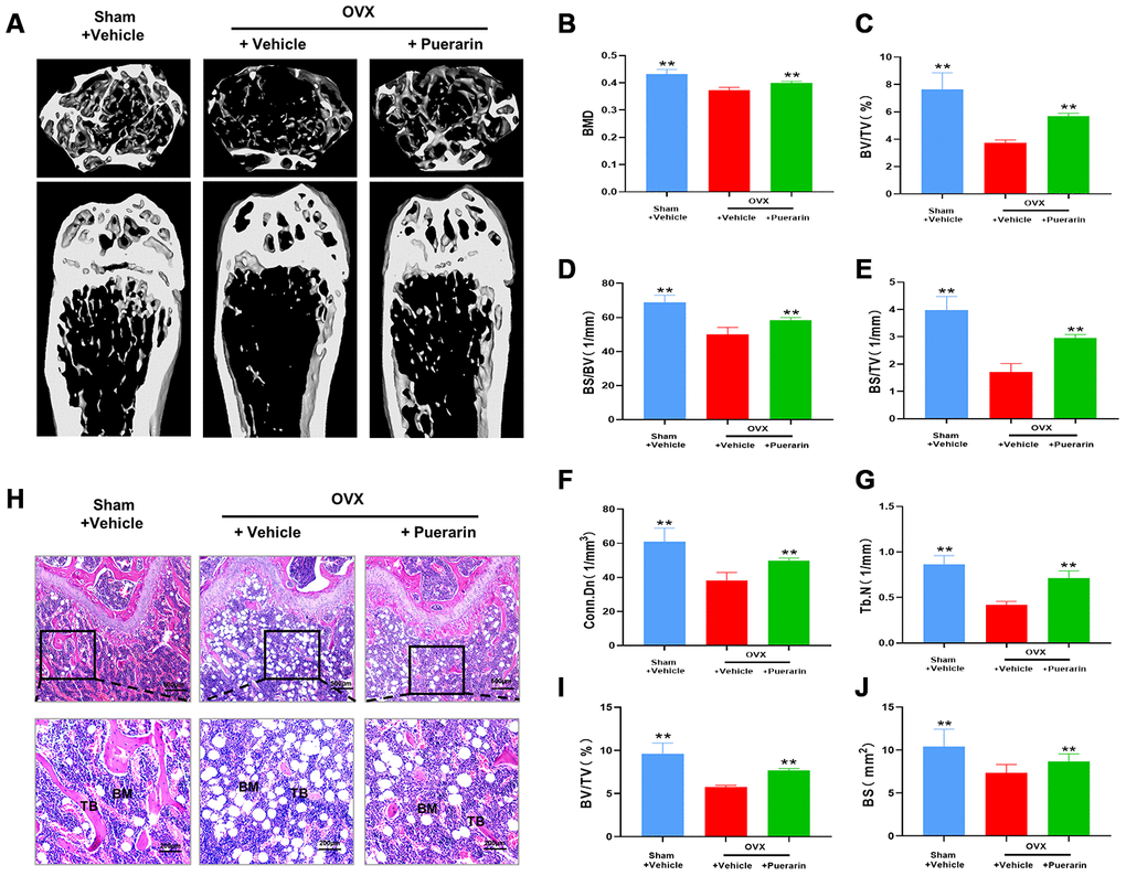 Puerarin protects against bone mass loss in the in vivo OVX-induced osteoporosis model mice. (A) Representative 3D- μCT images of the femur bone in the sham, OVX+vehicle, and OVX+puerarin group mice. (B–G) Comparative analysis of the bone structural parameters such as bone mass density (BMD in g/mm3), ratio of bone volume to total volume (BV/TV in %), ratio of bone surface to bone volume (BS/BV in 1/mm), ratio of bone surface to total volume (BS/TV in 1/mm), connectivity density (Conn.Dn in 1/mm) and trabecular number (Tb.N in 1/mm2)in the sham, OVX+vehicle, and OVX+puerarin group mice (n=5 per group). Note: **P 0.01 vs. OVX+vehicle group. (H) Representative H&E stained femur bone sections of the sham, OVX+vehicle, and OVX+puerarin group mice (n=5 per group). (I–J) The analysis of the bone parameters, BV/TV and BS based on the H&E staining sections of the femur bone from the sham, OVX+vehicle, and OVX+puerarin group mice (n=5 per group). Note: **P 0.01 vs. the OVX+vehicle group.