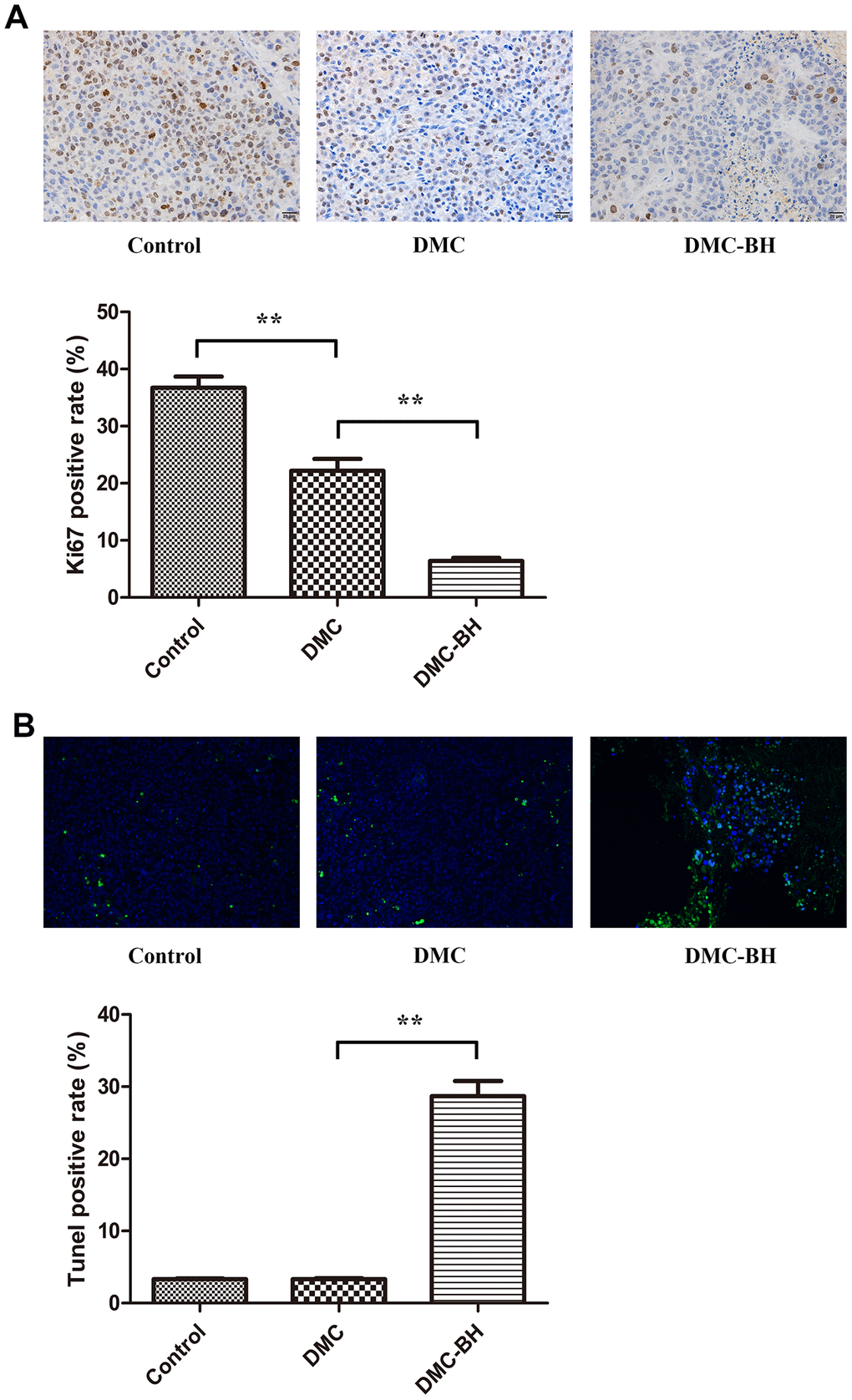 The effects of DMC-BH and DMC on orthotopic glioblastoma growth were analyzed by immunohistochemical staining. (A) The orthotopic glioblastoma growth potential after treatment with 20 mg/kg DMC-BH or DMC treatment was evaluated by Ki67 immunohistochemistry. (B) The orthotopic glioblastoma apoptosis rate after treatment with 20 mg/kg DMC-BH or DMC was analyzed by TUNEL staining.