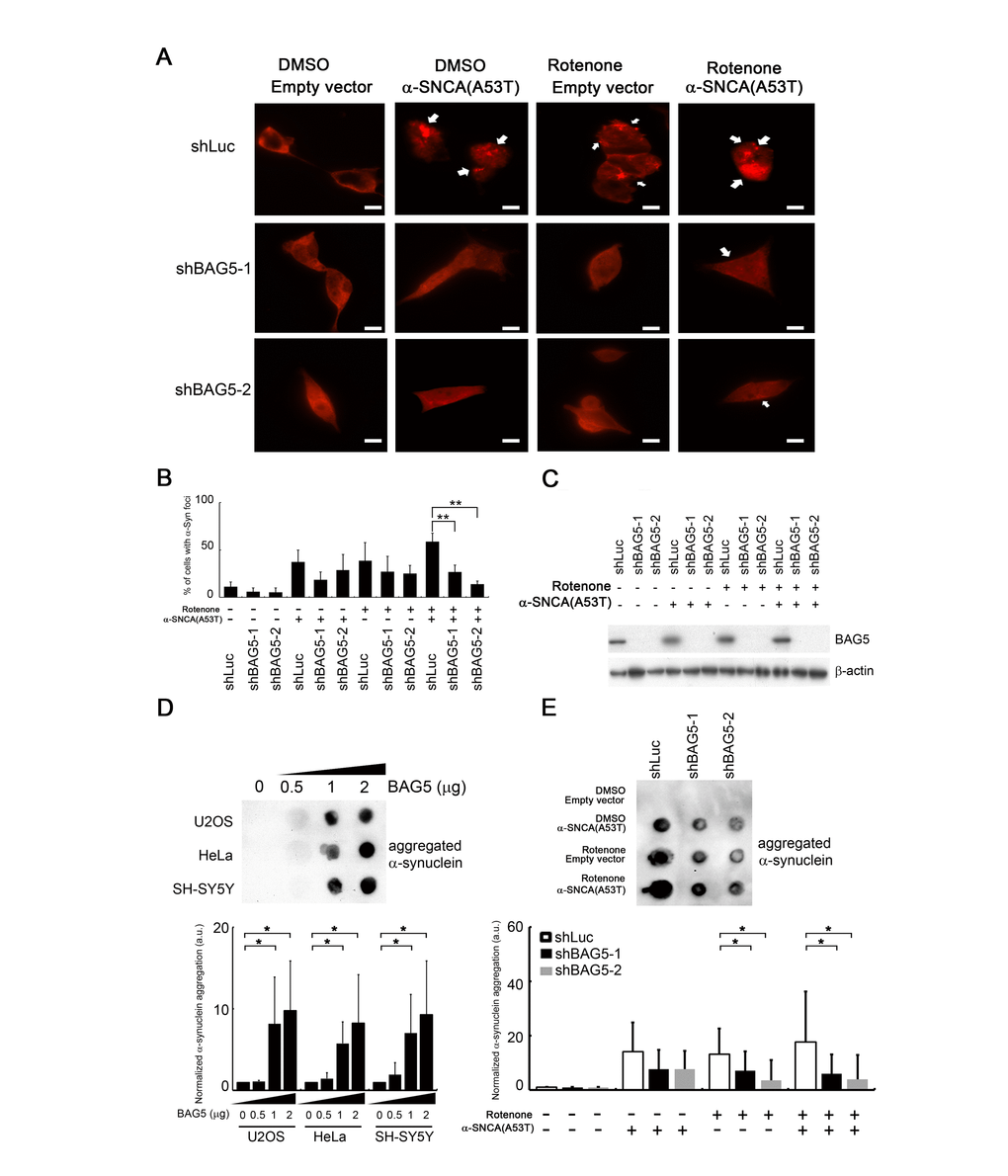 BAG5 expression is crucial for α-synuclein aggregation. (A) After rotenone treatment (10 μM) for 24 h, images of rotenone-treated α-synuclein (A53T)-expressing SH-SY5Y cells following BAG5 knockdown were captured. Arrows indicate α-synuclein-containing foci. Scale bar, 10 μm. (B) Quantified results in (A) are shown as the percentage of cells with foci (Student’s t-test; **, p C) Knockdown of BAG5 in (A) was displayed by Western blot analysis. (D) BAG5 increases SDS-insoluble aggregation of α-synuclein in U2OS, HeLa, and SH-SY5Y cells. α-Synuclein aggregation was detected by the filter-trap assay in cells transfected with various amounts of a BAG5-expressing plasmid. The lysate was diluted in SDS and filtered through nitrocellulose membranes. α-Synuclein immunostaining was detected by the α-synuclein antibody. A representative image and the densitometry data are shown (a.u., arbitrary unit). The values of α-synuclein aggregation were normalized to the amount of aggregation in the empty vector control (Student’s t-test; *, p E) SDS-insoluble α-synuclein aggregation in rotenone-treated and/or α-synuclein (A53T)-expressed SH-SY5Y cells is BAG5-dependent. α-Synuclein aggregation was detected by the filter-trap assay. The values of α-synuclein aggregation were normalized to the amount of aggregation in the vector or solvent control (Student’s t-test; *, p 