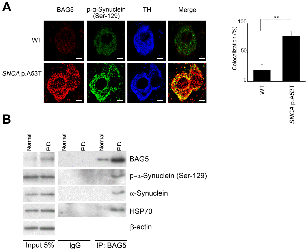 BAG5 is increased and colocalized with α-synuclein in SNCA p.A53T mice and PD patients. (A) Immunohistochemical staining of substantia nigra sections with a phospho-α-synuclein (Ser129) antibody revealed that the phospho-α-synuclein (Ser129) is expressed mainly in the substantia nigra. The expression of BAG5 (red) and p-α-synuclein (green) was detected mainly at the TH (blue)-positive excitatory synapse in SNCA p.A53T mice. The bars indicate 20 μm (Student’s t-test; **, p B) Lysates were prepared from human normal control and PD brains. Immunoprecipitations were performed with an anti-BAG5 antibody. Immunoprecipitates were sequentially probed with phospho-α-synuclein (Ser129), anti-α-synuclein, and anti-HSP70 antibodies. Five percent of each lysate used for immunoprecipitation was loaded as input and probed with anti-BAG5, phospho-α-synuclein (Ser129), anti- α-synuclein, and anti-HSP70 antibodies. β-Actin was used as a loading control.
