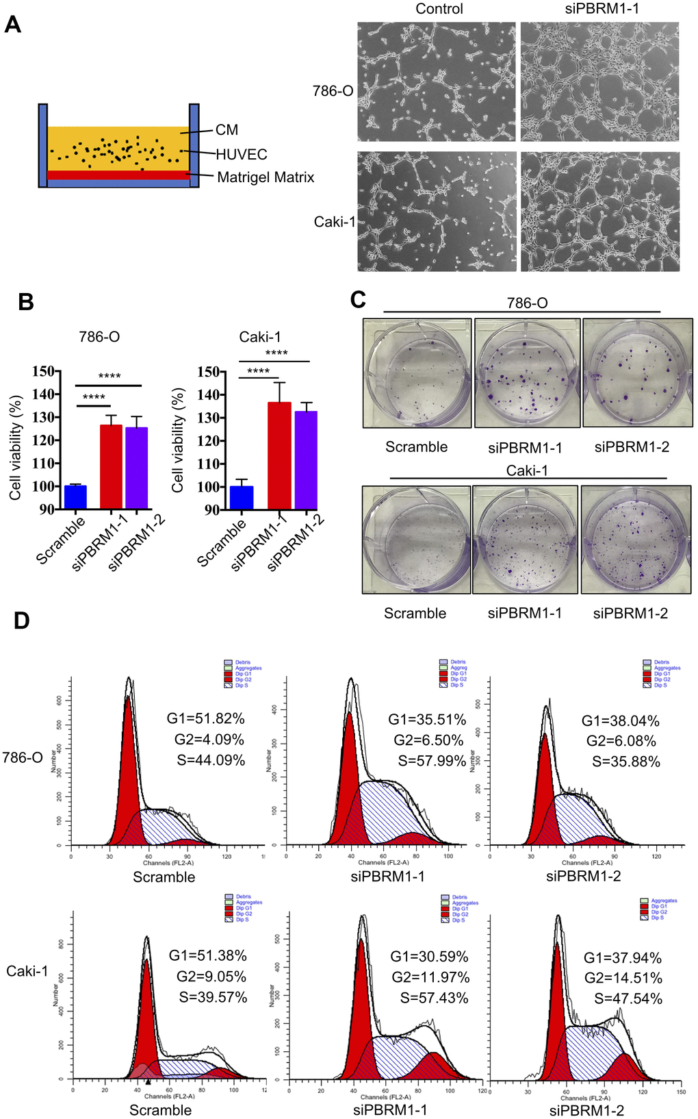 PBRM1 silencing enhances tumor angiogenesis and promotes cell proliferation of RCC cells in vitro. (A) Matrigel tube formation assay results show the tube-like structures formed in the matrigel by CM from control and PBRM1-silenced 786-O and Caki-1 cells. (B) MTT assay results show viability of control and PBRM1-silenced 786-O and Caki-1 cells. (C) The colony formation assay results show the total numbers of colonies formed by control and PBRM1-silenced 786-O and Caki-1 cells based on crystal violet staining. (D) Flow cytometry analysis shows the percentage of G1, S, and G2-M cells in control and PBRM1-silenced 786-O and Caki-1 cells based on PI staining. Note: The experiments were performed in triplicate and data are represented as means±SD; the statistical analysis was performed using Student’s t-test.
