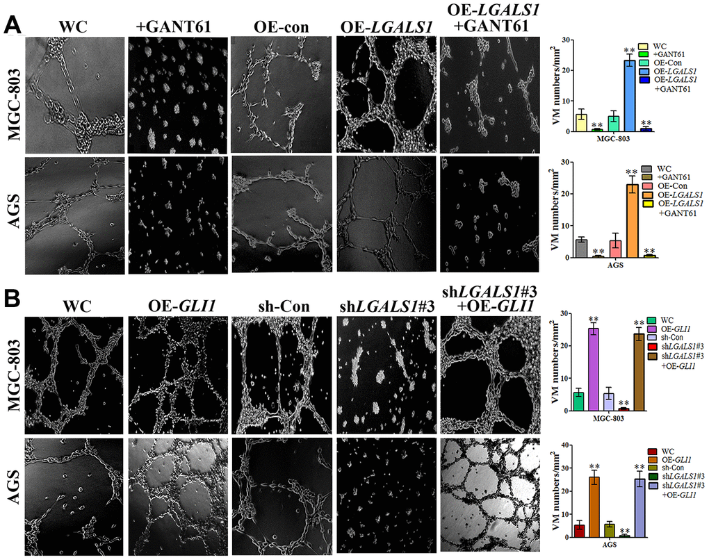 GAL-1 increases VM through the Hh signaling pathway. (A) Matrigel three-dimensional culture indicating that OE-LGALS1 efficiently increased tube-formation by MGC-803 cells and AGS cells, and the inhibition of this effect by GANT61. (B) sh-LGALS1 reduces the ability of MGC-803 cells and AGS cells to form tube-like structures. Simultaneous silencing of LGALS1 and overexpression of GLI1 rescued this reduction in tube-formation capacity. (×40 magnification; n=3).