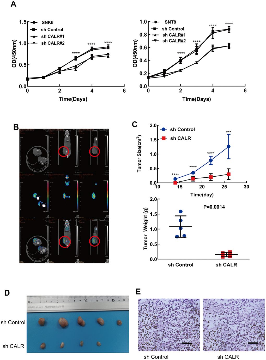 CALR knockdown suppresses in vitro and in vivo NKTCL cell growth. (A) CCK-8 assay results show the viability of SNK6 and SNT8 cells transfected with shCALR #1, shCALR #2 or shControl. (B) Representative images show the xenograft tumors at 14 days in mice subcutaneously injected with the shControl-transfected SNK6 cells. The red circles indicate visible tumors. (C, D) Xenograft tumor growth analysis shows the tumor volume and weight in mice subcutaneously injected with CALR knockdown SNK6 cells in comparison with those injected with shControl-transfected SNK6 cells. Knockdown of CALR inhibited tumor formation of the SNK6 cells in vivo (C, upper panel and D). The tumor weight was significantly reduced in the CALR-silenced group compared to the control group (C, lower panel). (E) Representative H&E stained sections show the morphology of xenograft tumors derived from mice injected subcutaneously with shControl or CALR-knockdown SNK6 cells (bar=200μm). Note: The data are shown as means ± standard deviation; **** P P 