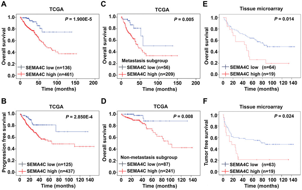 High SEMA4C expression correlates with poor survival outcomes in CRC patients. (A, B) Kaplan-Meier survival curves show OS and PFS of high- and low-SEMA4C expressing CRC patients from the TCGA database. (C, D) Kaplan-Meier survival curves show the OS of high- and low-SEMA4C expressing CRC patients belonging to the metastatic and non-metastatic subgroups. (E, F) Kaplan-Meier survival curves show OS and TFS of high- and low-SEMA4C expressing CRC patients from the TMA-colon cancer cohort.