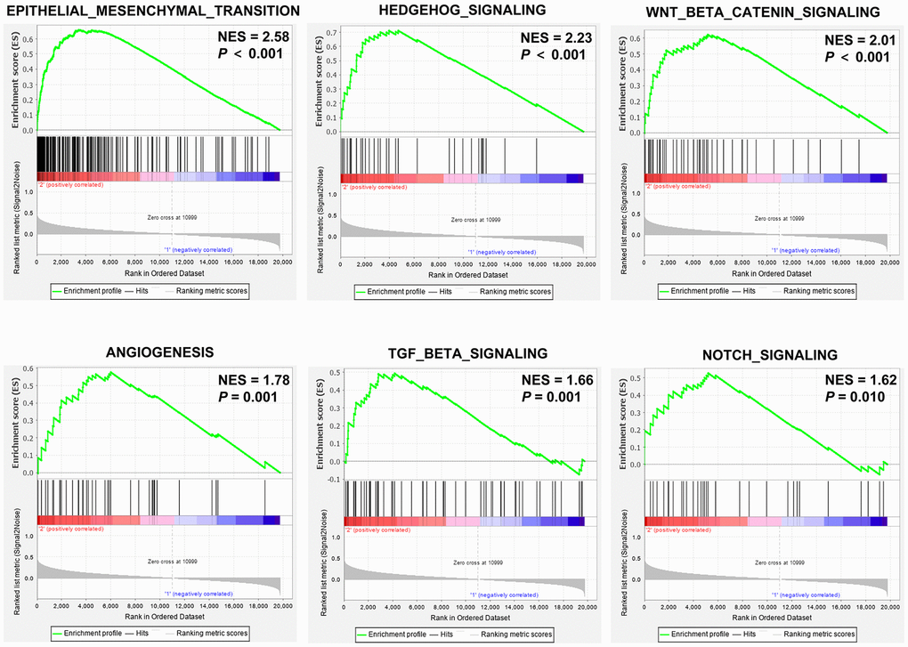 GSEA enrichment plots of the TCGA-CRC dataset. GSEA results show the enrichment of gene sets related to epithelial mesenchymal transition (EMT), hedgehog signaling, Wnt/β-catenin signaling, angiogenesis, TGF-β signaling, and notch signaling in CRC patients with high SEMA4C expression. Note: NES, normalized enrichment score.