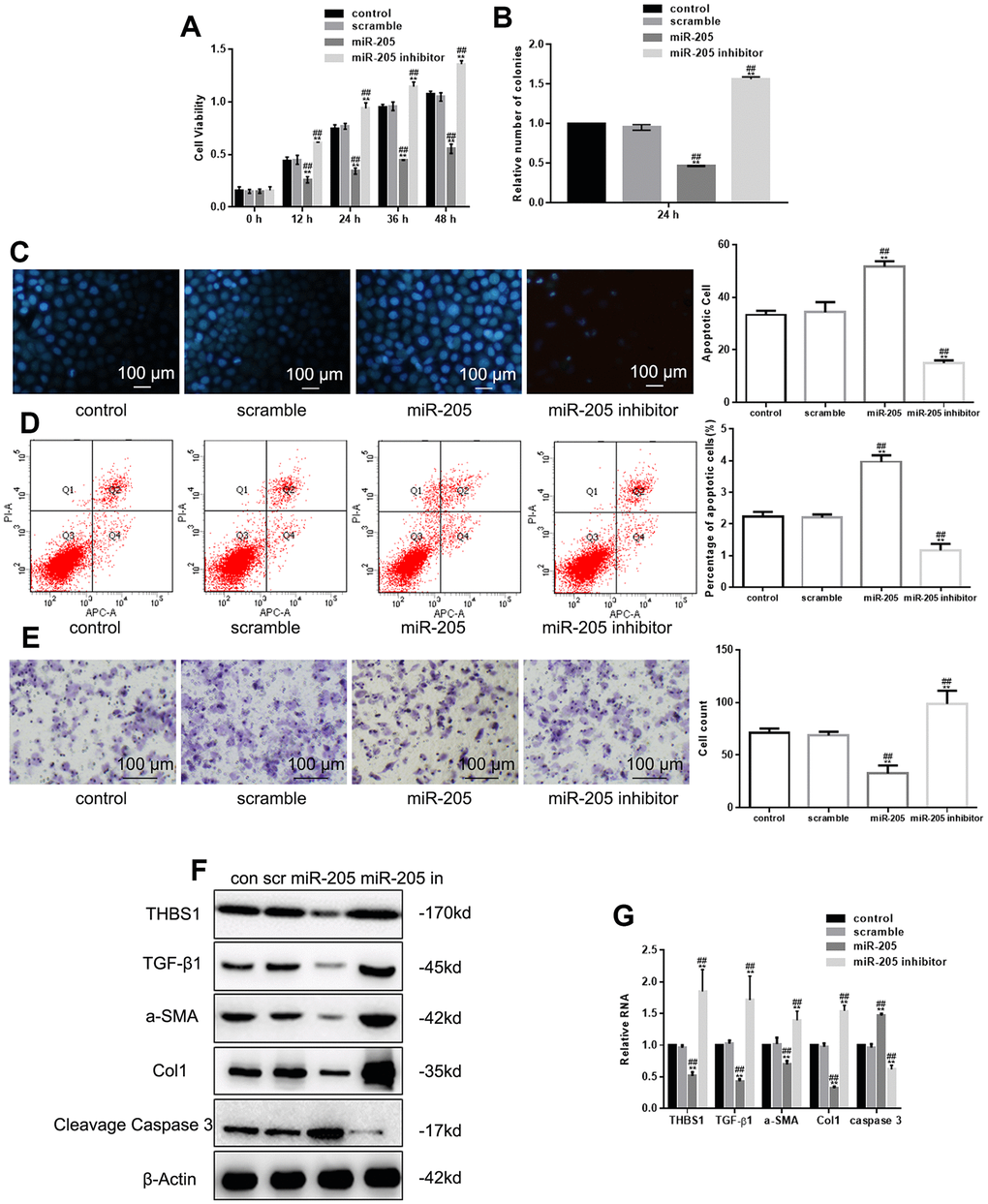 miR-205 inhibits growth and migration of hypertrophic scar fibroblasts. (A, B) The viability of cells deprived miR-205 or expressing miR-205 was measured by MTT and colony formation assay. **P C, D) The apoptosis of cells deprived miR-205 or expressing miR-205 was measured by Hoechst 33258 assay and Annexin V-PI assay. **P E) The migration of cells deprived miR-205 or expressing miR-205 was measured by Transwell assay. **P F, G) THBS1, TGF-β1, α-SMA, Col1, and Cleavage Caspase 3 expression was detected. Cells were transfected with control, scramble, miR-205, and miR-205 inhibitor, respectively. **P 