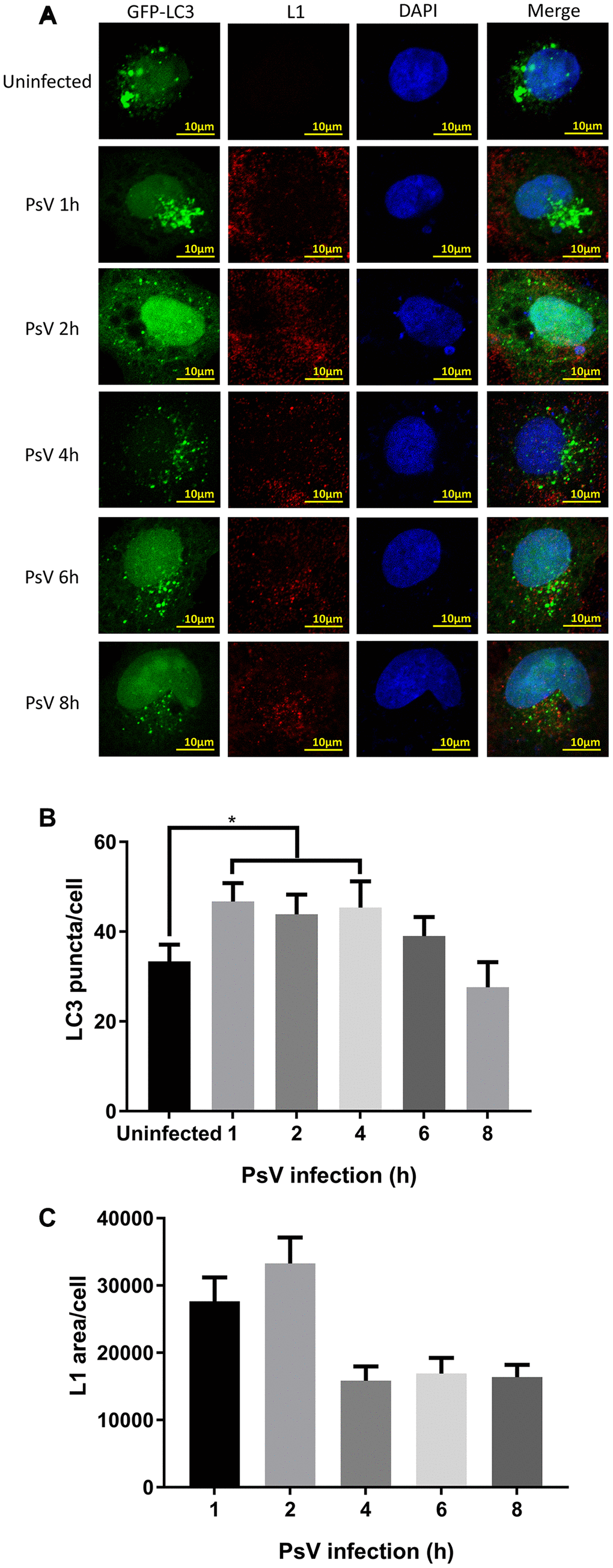 LC3 puncta are increased after HPV11 PsV infection of NHEK cells. (A) Confocal microscopy analysis of GFP-LC3 puncta and L1-stained HPV11 PsVs. The NHEK nucleus was stained with 4’,6-diamidino-2-phenylindole (DAPI). (B) Quantification of GFP-LC3 puncta in panel (A). (C) Quantification of the total L1 staining area in panel (A). The graphs represent the mean and standard deviation of three biological independent experiments, and at least 100 cells were analyzed for each repeat. Significant differences were identified by Student’s t test. *, P 