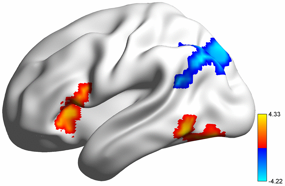 Rendering of regions with significant COMT genotype and sex effects on task-related brain activation. All results were corrected at voxel p COMT genotype effect; cool color, sex effect.