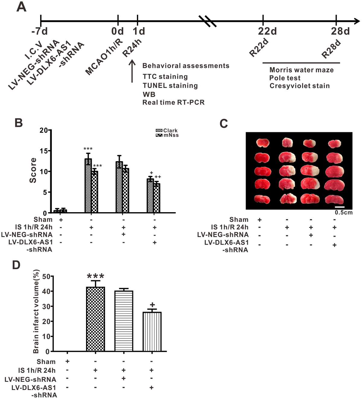 Protective effect of DLX6-AS1 silencing against cerebral ischemia ...