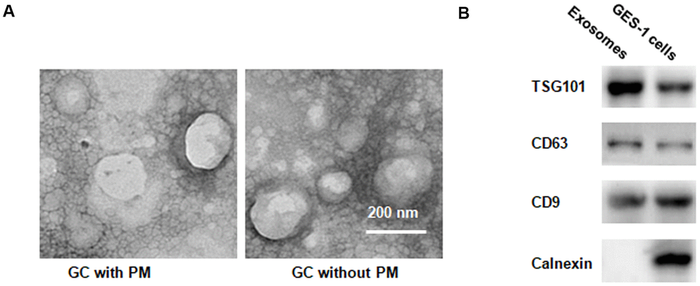 EVs identification in peritoneal fluid. (A) Transmission electron microscopy demonstrating many EVs B) Western blotting illustrating the presence of TSG101 and CD63, two common EV markers, in EV fraction isolated from peritoneal fluid.