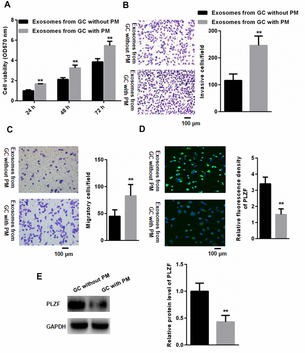 PM-derived EVs reduce PLZF expression in HMrSV5 cells and promote their invasive ability. (A) CCK-8 assay indicated that EVs isolated from GC patients with PM significantly increased the viability of HMrSV5 cells compared to that of without PM. (n=3, one way ANOVA) (B) Trans-well assay illustrating invasion of HMrSV5 cells incubated with EVs isolated from peritoneal fluid of GC patients with and without PM. (C) For migration assays, more adhesive HMrSV5 cells were found in those pretreated by EVs isolated from peritoneal fluid in GC patients with PM compared those without PM. (D) Immunofluorescence and (E) western blotting showing that pretreatment with EVs isolated from patients with PM reduces the PLZF expression in HMrSV5 cells. (n=3, Student’s t-test for B, C, D, E).