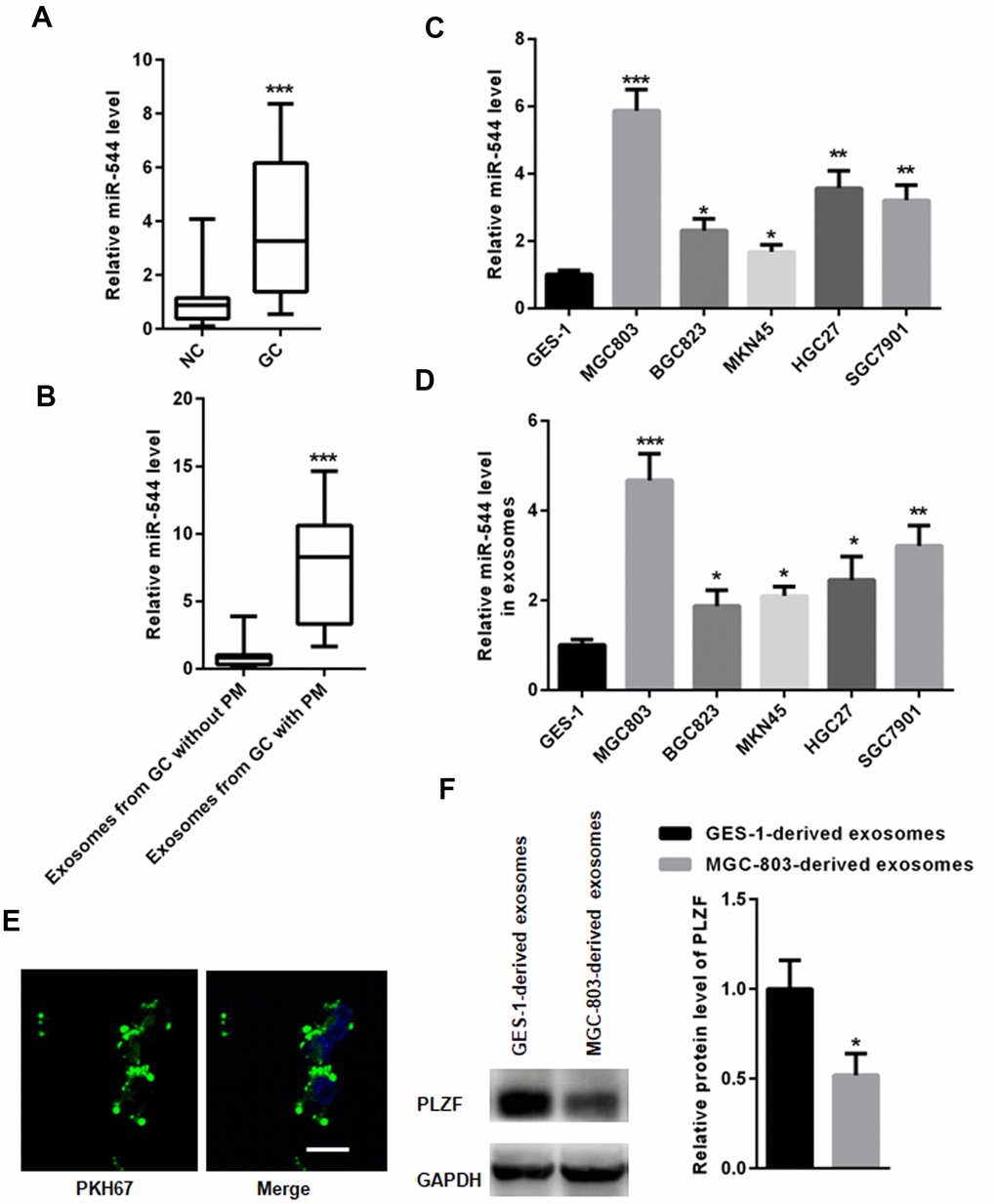 miR-544 is transferred from GS-derived EVs to peritoneal cells. (A) RT-PCR of miR-544 in GC tissues. (B) RT-PCR of miR-544 in EVs isolated from GC patients with and without PM. (n=68 for GC patients without PM, n=65 for GC patients with PM, two-tailed unpaired student’s t-tests) (C) RT-PCR of miR-544 in GC cell lines MGC803, BGC823, MKN45, HGC27, and SGC7901. (D) RT-PCR of miR-544 in EVs isolated from GC and GES-1 cells. (E) PKH67-labeled EVs in HMrSV5 cells (bar represents 10 μm). (F) PLZF expression in HMrSV5 cells co-cultured with MGC-803-and GES-1-derived EVs. (n=3, one way ANOVA for C, D, E and F).