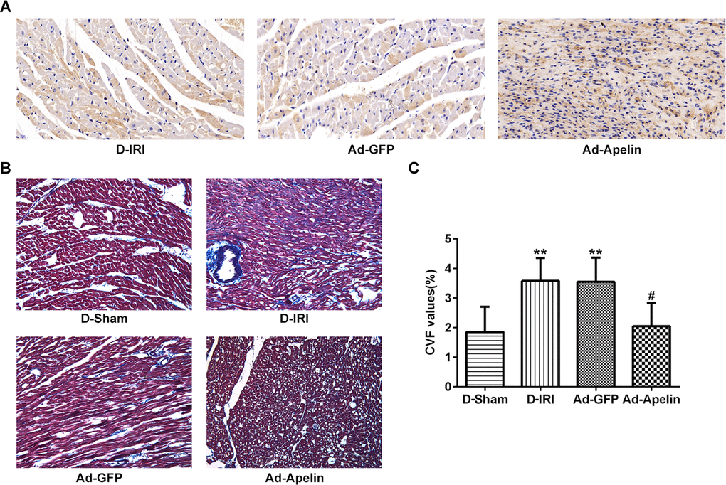Impacts of Apelin on PPAR-alpha expression and CVF values in D-IRI rats. (A) Examination for PPAR-alpha expression by immunohistochemistry staining. Magnification, ×200. (B, C) CVF values in D-IRI rats was examined by Masson’s staining. ** P#P
