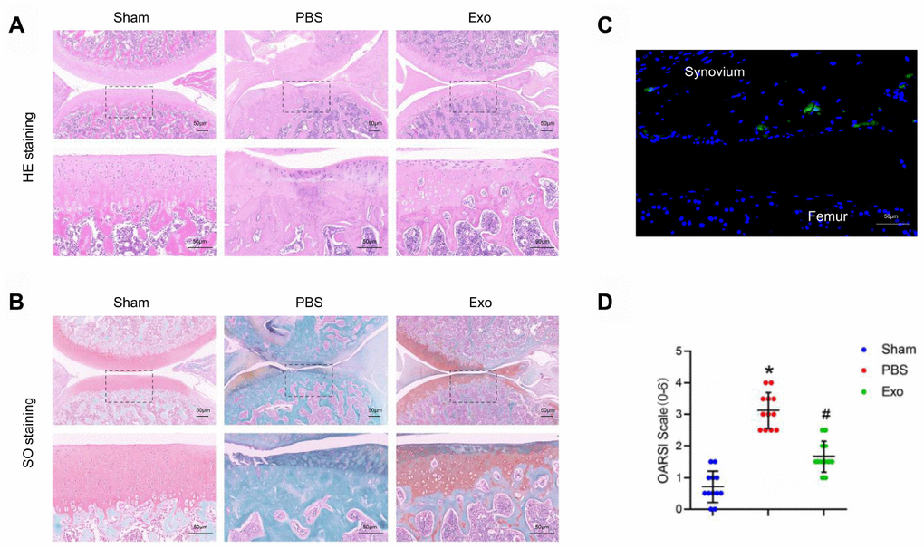 BMSC exosomes prevented cartilage destruction in a rat model. (A) Representative images of HE staining in knee sections. Scale bar: 50 μm. (B) Representative images of Safranin O / Fast Green staining in knee sections. Scale bar: 50 μm. (C) Representative adoptive Dil-labelled BMSC-Exos (green fluorescence) in a knee joint. Scale bar: 50 μm (D) Evaluation of cartilage destruction using the OARSI scoring system. *p 