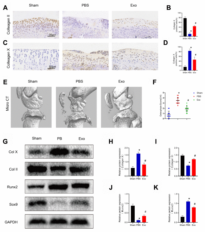 BMSC exosomes inhibited chondrocyte hypertrophy and reduced osteophyte formation in the rat model. (A) and (B) Immunohistochemistry and analysis of collagen II in knee sections. Scale bar: 50 μm. (C) and (D) Immunohistochemistry and analysis of collagen X in knee sections. Scale bar: 50 μm. (E) Micro-CT scan and three-dimensional reconstruction of the knee joint in each experimental group. (F) Osteophyte score and quantitative analysis of the volume of the region of interest (ROI). (G–K) Western blot results and analyses of cartilage tissue. *p 
