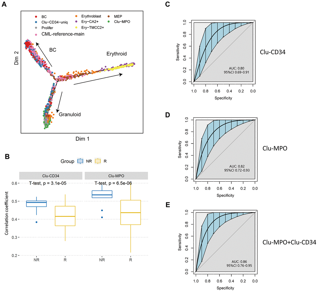 Validation of prognostic cell populations in 59 CML patients treated with imatinib. (A) Pseudotime trajectory of the primitive cells in peripheral blood. Cells are colored based on their identities in the integrated datasets with CML-reference or the erythroid clusters. (B) Box plots comparing the correlation coefficients of Clu-CD34 (left) and Clu-MPO (right) between 13 imatinib nonresponders (NR) and 83 responders (R) from GSE130404. The correlation coefficients were calculated using Pearson correlation of gene expression signatures of these two clusters with the gene expression profile in each CML patient treated with imatinib (see Methods). (C, D) ROC curves illustrating the classification performance of Clu-CD34 (c) and Clu-MPO (d) gene expression signatures of 13 imatinib nonresponders and 83 responders from GSE130404. The blue shade denotes the 95% confidence interval of the sensitivity at a given specificity point. AUC, area under the ROC curve are indicated. e) We integrated Clu-CD34 and Clu-MPO clusters together to predict imatinib resistance. ROC curves illustrating the classification performance of gene expression signatures of 13 imatinib nonresponders and 83 responders from GSE130404. The blue shade denotes the 95% confidence interval of the sensitivity at a given specificity point. AUC, area under the ROC curve are indicated.
