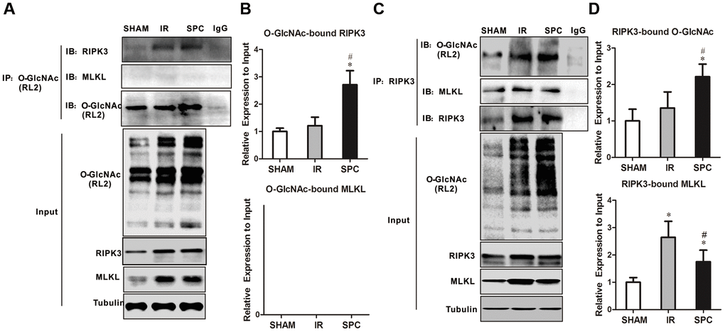 SPC increased O-GlcNAcylated RIPK3 and inhibited the combination of RIPK3 and MLKL. (A) RIPK3 and MLKL were detected in O-GlcNAc immunoprecipitates. Representative protein images were performed. (B) Quantitative analysis of O-GlcNAcylated RIPK3 and MLKL. n = 3 /group. (C) O-GlcNAc and MLKL in RIPK3 immunoprecipitates. Representative protein images were shown. (D) Quantitative analysis of O-GlcNAcylated RIPK3 and the complex between RIPK3 with MLKL. n = 3 /group.