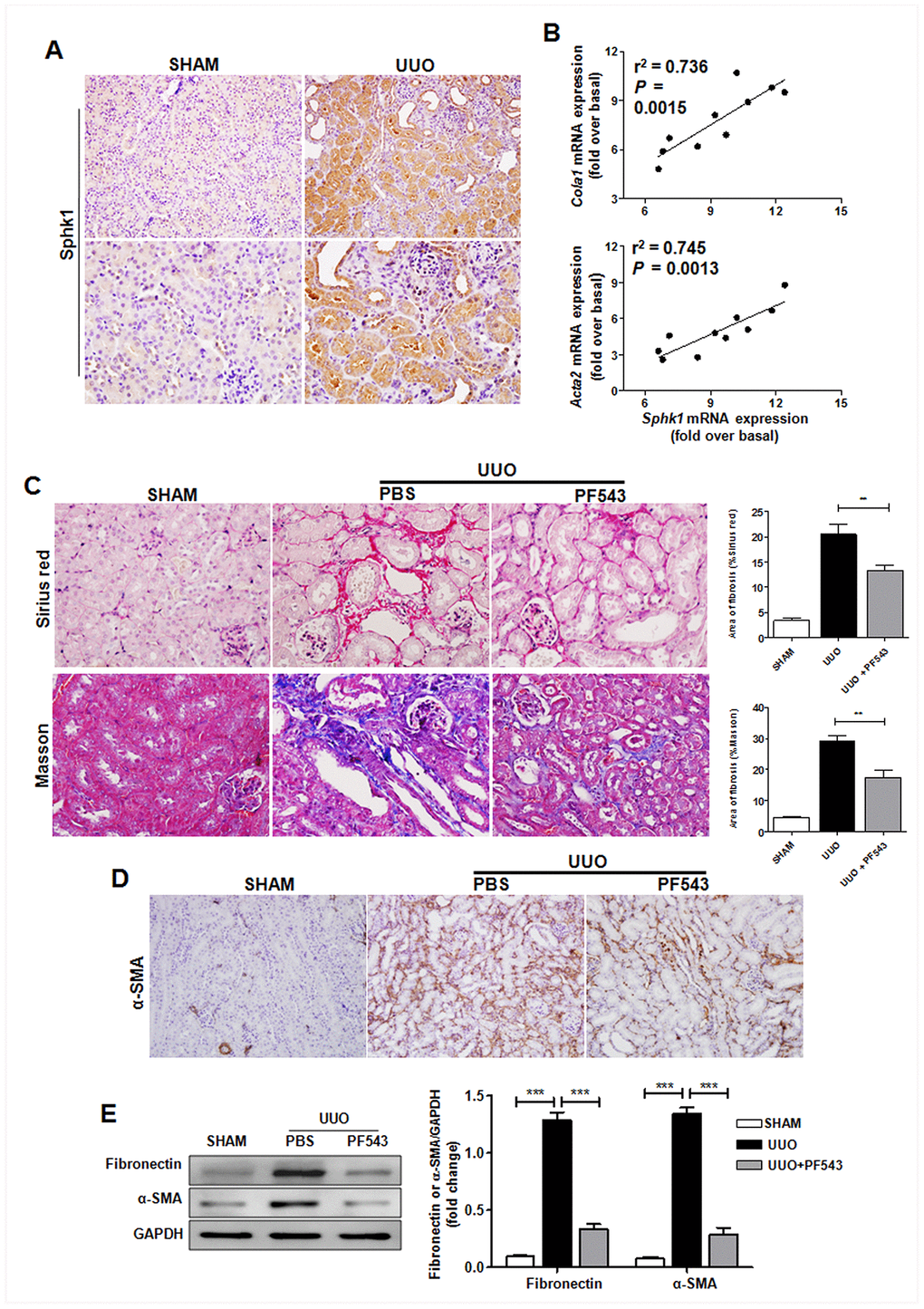 Sphk1 is critical for UUO-induced kidney fibrosis in mice. (A) Sphk1 expression in kidney tissues of Tnfsf14+/+ mice after UUO surgery for 7 days was measured by immunohistochemistry (upper lane, original magnification ×200; lower lane, original magnification ×400). (B) Linear regression showed a close correlation between Sphk1 mRNA expression and Cola1 and Acta2 mRNA expression in kidney tissues of Tnfsf14+/+ mice after UUO surgery for 7 days. Spearman’s correlation coefficient and P value are shown (n = 10). (C–E) After UUO surgery, PF543 (1 mg/kg/day) was injected intraperitoneally for consecutive 7 days, and then kidney tissues were collected from each group. (C) Sirius Red and Masson staining of kidney tissues sections. Original magnification ×400. (D) α-SMA expression in kidney tissues was measured by immunohistochemistry. Original magnification ×200. (E) Western blot analyses of renal fibronectin and α-SMA protein in kidney tissues. Representative western blot (Left and quantitative data (Right) are presented. Sham group was used as the control of UUO. The data were representative of the results of three independent experiments. All values are represented as means ± SEM. n = 5 per group. ***P 