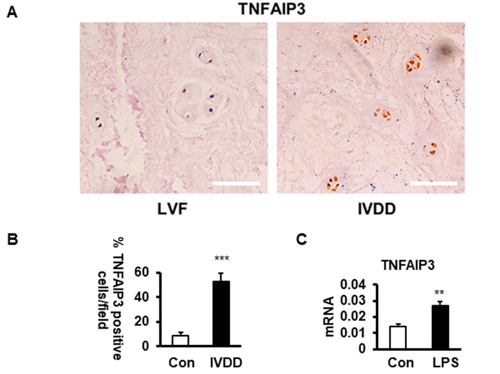 The expression of TNFAIP3 in human nucleus pulposus tissues. (A, B) TNFAIP3 expression was measured by immunohistochemistry from the IVD section from LVF and IVDD patients (magnification × 100, n>5). (B) Human NPCs expressing TNFAIP3 were enumerated from the above sections, results are expressed as a percent of the total number of NPCs. (C) TNFAIP3 expression was measured at the mRNA level by qPCR from the primary cell culture of the NPCs from LVF patients. Con and LPS, cell culture representatively treated with no and with LPS, data are shown by the mean ± standard deviation from 3 independent replicates. *** P0.05 by t-test. TNFAIP3, tumor necrosis factor α-induction protein 3; IVD, intervertebral disc; LVF, patients with lumbar vertebral fracture as non-IVDD controls; IVDD, patients with intervertebral disc degeneration; LPS, lipopolysaccharide; Con, normal human NPCs culture from LVF patients with no LPS treatment; LPS, the normal human NP cell culture treated with LPS at 200 ng/mL for 24 h.