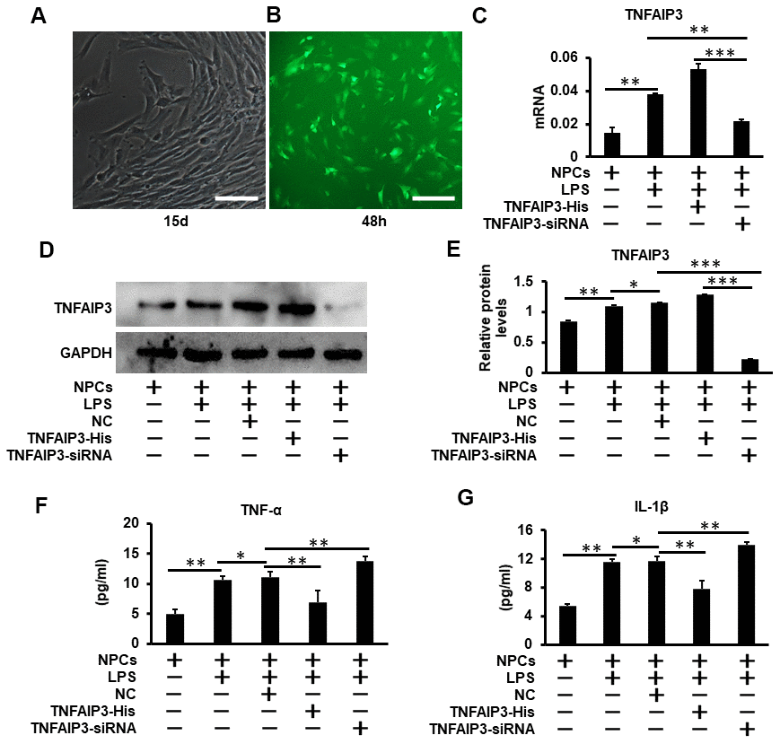 TNFAIP3 reduces pro-inflammatory cytokines expression in LPS-stimulated human NPCs. (A) Human primary nucleus pulposus cells isolated from patients with lumbar fractures (LVF), amplification × 100. (B) Human nucleus pulposus cells were transfected with Ad-TNFAIP3 for 48 h. (C–E) TNFAIP3 responses to inflammatory stimulation. After treatment with LPS for 24 h, the mRNA and protein expression levels of TNFAIP3 were measured by RT-qPCR and Western blot, respectively. (F, G) After transfected with TNFAIP3-His and TNFAIP3-siRNA for 24 h, then stimulated with LPS for 24 h, the expression levels of TNF-α, IL-1β were tested by ELISA. Data are represented by the mean ± standard deviation of 3 independent experiments. *** P0.05 by the Student t-test. Error bars indicate standard deviations. NC, negative control (adenovirus vector without TNFAIP3); TNFAIP3-His, Adenovirus with TNFAIP3 overexpression; TNFAIP3-siRNA, Adenovirus with TNFAIP3 knockdown. TNFAIP3-His +LPS, human NPCs transfected with TNFAIP3-His and then treated with LPS. TNFAIP3-siRNA +LPS, human NPCs transfected with TNFAIP3-siRNA and then treated with LPS.