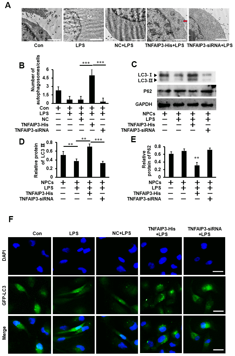 TNFAIP3 promotes autophagy in LPS-stimulated human NPCs. (A) The effect of TNFAIP3 on autophagy in LPS-stimulated human NPCs. Morphological observation of autophagosome under transmission electron microscope, amplification × 15,000, n>3. (B) The number of autophagosomes. (C–E) The NPCs were the primary cell cultures from LVF patients without IVDD. Con, no LPS treatment; LPS+TNFAIP3-His and LPS+ TNFAIP3-siRNA, TNFAIP3 and its siRNA were delivered into the NPCs by adenovirus expressing TNFAIP3-His and TNFAIP3-siRNA, respectively. Western blot analysis of LC3II and P62 expression in human NPCs (F) Human NPCs were transfected with adenovirus containing GFP-LC3 and the formation and distribution of GFP-LC3 punctate were observed under confocal microscopy, amplification × 800. Data are represented by the mean ± standard deviation of 3 independent experiments. *** P0.05 by the Student’s t-test.
