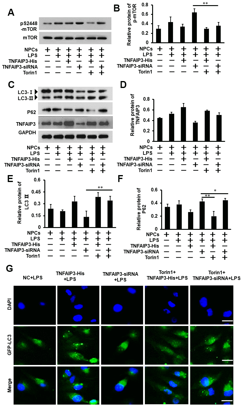 Inhibition of mTOR signaling ameliorates autophagy in the inflammatory human NPCs. (A, B) Torin1 decreases mTOR signaling in inflammatory human NPCs. The phosphorylation level of mTOR at S2448 was measured by Western blot (A). Torin1 treated cells at 20 nM for 24 h. (B) With its quantification normalized to mTOR level. (C, D) Inhibition of mTOR signaling increased autophagy by Western blot for LC3II protein level. (D) With its quantification normalized to GAPDH for TNFAIP3. (E, F) The relative quantification of LC3II and P62 protein. (G) Human NPCs were transfected with adenovirus containing GFP-LC3 and the formation and distribution of GFP-LC3 punctate were observed under confocal microscopy, amplification × 800. Data are represented by the mean ± standard deviation of 3 independent replicates. *** P0.05 by the Student t-test.