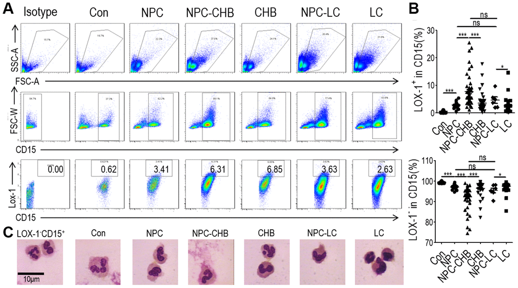 Accumulation of LOX-1+ PMN-MDSCs in NPC survivors. (A) Gating strategy and statistical analysis of LOX-1+ PMN-MDSCs by flow cytometry analysis in NPC survivors with CHB (NPC-CHB), NPC survivors with LC (NPC-LC), and their control, including NPC survivors without CHB, patients with CHB and patients with LC, and healthy donors (Con). (B) Typical morphology of sorted LOX-1+ PMN-MDSCs from each group and LOX-1−PMN. Abbreviations: PMN-MDSC, polymorphonuclear myeloid-derived suppressor cell; NPC, nasopharyngeal carcinoma; CHB, chronic hepatitis B; LC, liver cirrhosis.