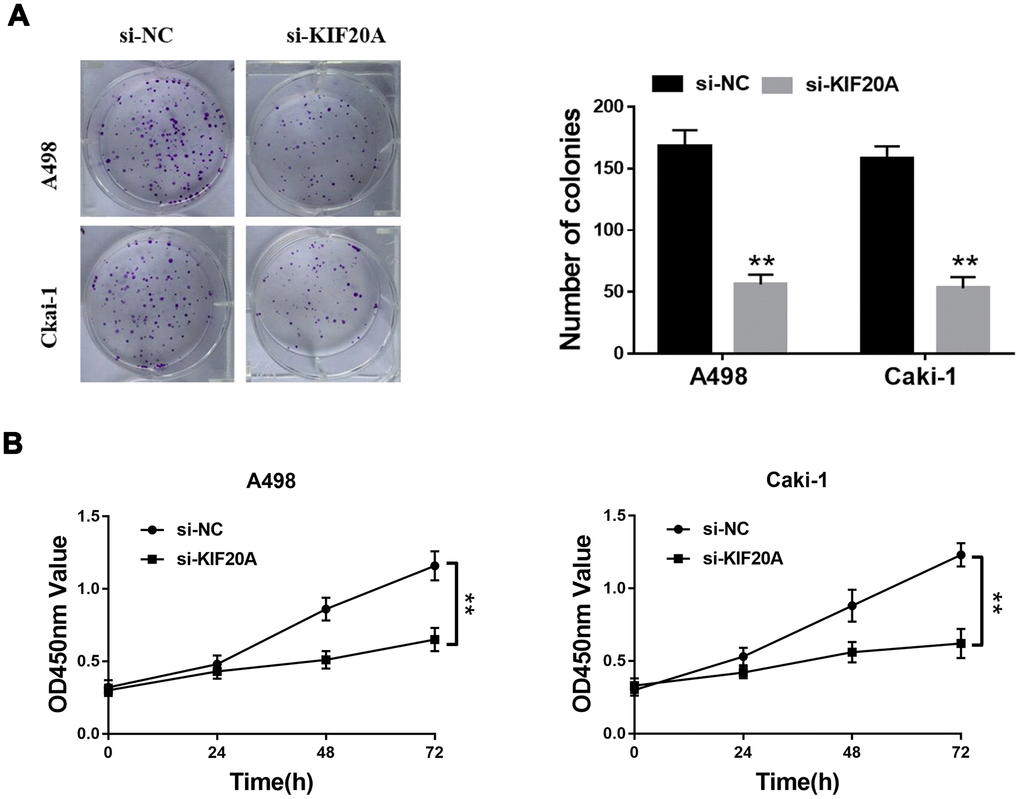 KIF20A regulates the proliferation of renal cancer cells. (A) Downregulation of endogenous KIF20A reduced the mean colony number in the colony formation assay; (B) MTT assays revealed that downregulation of endogenous KIF20A significantly reduced the cell viability.