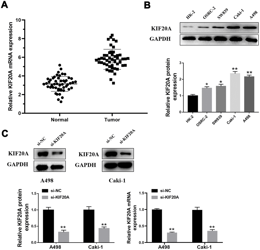 KIF20A is up-regulated in ccRCC. (A) Expression of KIF20A was frequently up-regulated in 50 ccRCC tumor samples compared with 50 adjacent healthy tissue by qPCR; (B) Western blotting of KIF20A expression in HK-2, OSRC-2, SW839, Caki-1 and A498 cell lines; (C) Western blotting and qPCR of indicated cells transfected with KIF20A-RNAi-vector, KIF20A-RNAi.