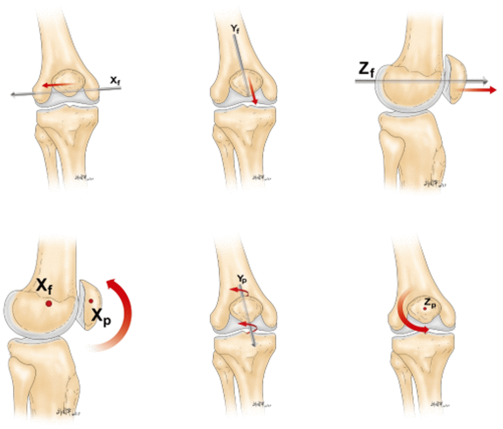 Patella Tracking Disorder - Patella Conditions - Knee - Conditions