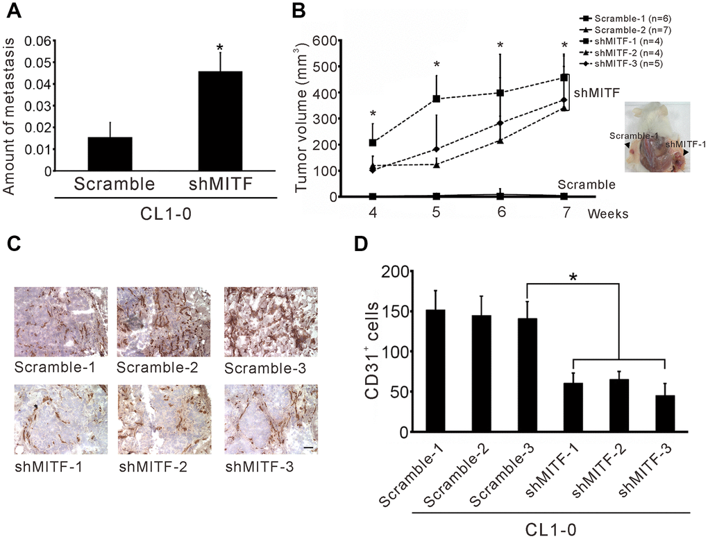 Knockdown of MITF increases metastasis and tumorigenesis but inhibits angiogenesis. (A) Intravenous injection with stable shMITF-harboring and scramble CL1-0 cells to SCID mice. The lung metastases were estimated by using real-time PCR for detection of the human Alu repeats. (B) Subcutaneous injection with stable shMITF-harboring cells into the right dorsal region and scramble cells into the left dorsal region of SCID mice. The tumor volume was measured every week. The mouse number of each group is listed on the plot. *p C) The cells mixed with Matrigel and injected subcutaneously. At 10 days, the plug was dissected and assayed the CD31 positive cells by immunochemistry. Scale Bar, 25 μm. (D) The CD31 positive cells were counted by two blinded observers. A total of 21 fields/group (3 plugs × 7 fields) were analyzed. *p
