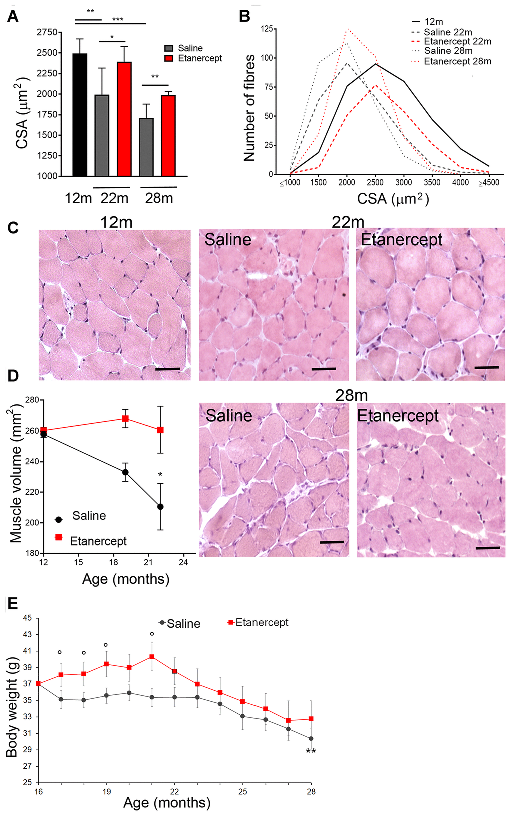 Blockade of TNFα by Etanercept inhibited sarcopenia during spontaneous aging. Measurement of cross-sectional area (CSA) (A) and fiber size distribution (B) in GS of 12 months old mice and in control (saline) or Etanercept-treated mice at 22 and 28 months of age. *=pC) Representative histochemical images of GS muscle sections analyzed in 12 months old mice and in control or Etanercept-treated mice at 22 and 28 months of age. Scale bar=50 μm (magnification of the16x) (D). MRI measurement of muscle volume for control or Etanercept-treated mice at 12, 19 and 22 months of age. *=pE) Body weight of control and Etanercept-treated mice monitored between 16 and 28 months of age. ** =p