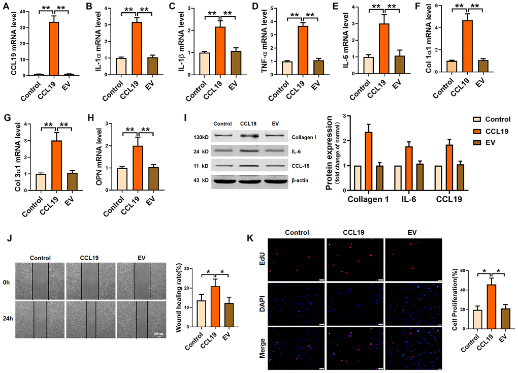 Effects of CCL19 on VSMCS inflammation, ECM deposition, proliferation and migration. (A) Detection of overexpression efficiency of CCL19 plasmid was measured by qRT-PCR. The inflammatory cytokine IL1-α (B), IL-1β (C), TNF-α (D), IL-6 (E) and the deposition of ECM such as collagen1 (F), collagen3 (G) and OPN (H) were detected by qRT-PCR.n=5 (I) Western blot showed the expression of proteins collagen1 and IL-6. n=4. Migration (J) and proliferation (K) of VSMCS after overexpressing CCL19. n=6. EV: Empty vector. *P