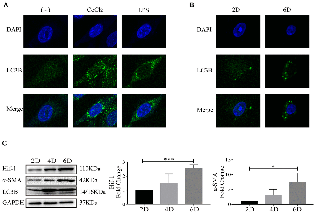 Autophagy occurred when hepatic stellate cells were activated. (A) LX-2 cells were treated with 100 μM CoCl2 or 2 μg/ml LPS for 8 h. (B) Culture-activated primary HSCs from mice were cultured up to 2 days or 6 days. Immunofluorescence assay was performed to detect LC3B (FITC) in CoCl2- or LPS-treated LX-2 cells (A) and culture-activated primary HSCs from mice cultured up to 2 days or 6 days (B). Images were captured by confocal microscope. (C) Culture-activated primary HSCs from mice were cultured up to 2 days, 4 days or 6 days. Cells were collected at indicated time and cell lysates were subjected to detect Hif-1α, α-SMA and LC3B with Western blot. Densitometric analysis for Western blot was performed and data were expressed as mean ± SD, *P P 