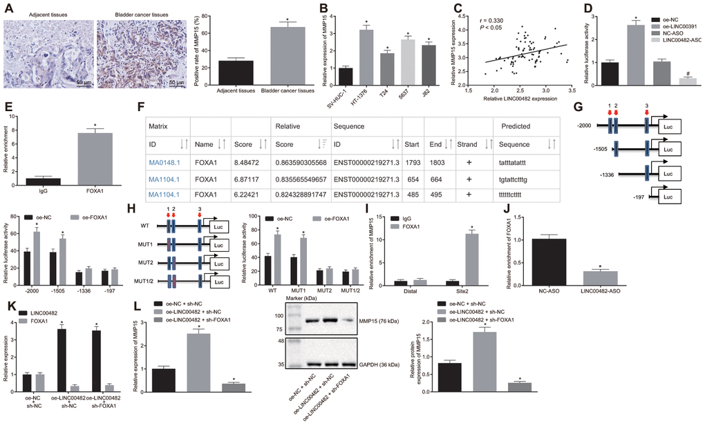 LINC00482 up-regulates the expression of MMP15 by recruiting FOXA1. (A) MMP15 expression in bladder cancer and adjacent normal tissues detected by immunohistochemistry (× 200), * p vs. adjacent normal tissues; (B) Expression of MMP15 in 4 kinds of bladder cancer cells and SV-HUC-1 cell detected by RT-qPCR; * p vs. SV-HUC-1 cell; (C) The correlation between LINC00482 and MMP15 expression in the bladder cancer tissues analyzed by Pearson correlation coefficient; (D) Dual-luciferase reporter gene assay was used to study the effect of LINC00482 on the activity of MMP15 promoter, * p vs. the oe-NC group, # p vs. the NC-ASO group; (E) The interaction between LINC00482 and FOXA1 verified by RIP assay, * p vs. the IgG group; (F) FOXA1 protein might combine the three sites of MMP15 promoter region by online analysis; (G) The truncated MMP15 recombinant luciferase reporter vector co-transfected with FOXA1 expression vector into HT-1376 cells for dual-luciferase reporter assay, * p vs. the oe-NC group; (H) the mutated MMP15 recombinant luciferase reporter vector co-transfected with FOXA1 expression vector into HT-1376 cells for dual-luciferase reporter assay, * p vs. the oe-NC group; (I) Enrichment of FOXA1 at site 2 in MMP15 promoter region analyzed by ChIP assay, * p vs. the IgG group; (J) Enrichment FOXA1 on MMP15 after silencing LINC00482 in HT-1376 cells detected by ChIP assay, * p vs. the NC-ASO group; (K) Transfection efficiency of LINC00482 and FOXA1 in each group by RT-qPCR, * p vs. cells treated with oe-NC + sh-NC; (L) The expression of MMP15 after treatment of oe-LINC00482 and sh-FOXA1 detected by RT-qPCR and Western blot analysis, * p vs. cells treated with oe-NC + sh-NC. The measurement data were presented as mean ± standard deviations. Paired t-test was used for intra-group comparison, while differences between two groups were compared by unpaired t test. Comparisons among multiple groups were analyzed by one-way analysis of variance, followed by Tukey’s post-hoc test. Experiments were repeated three times.