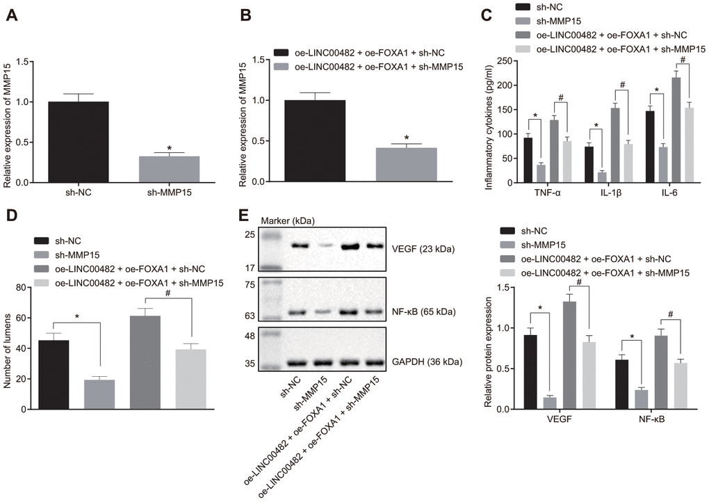 Silencing LINC00482 inhibits inflammation and angiogenesis through down-regulation of MMP-15 by targeting FOXA1. (A) The interference efficiency of MMP15 confirmed by RT-qPCR after treatment of sh-MMP15, * p vs. cells treated with sh-NC; (B) The interference efficiency of MMP15 confirmed by RT-qPCR after treatment of oe-LINC00482 + oe-FOXA1 + sh-MMP15, * p vs. cells treated with oe-LINC00482 + oe-FOXA1 + sh-NC; (C) Expression levels of TNF-α, IL-1β, IL-6 tested by ELISA, * p vs. cells treated with sh-NC, # p vs. cells treated with oe-LINC00482 + oe-FOXA1 + sh-NC; (D) The tube formation ability after treatment of sh-MMP15, oe-LINC00482 or oe-FOXA1 in each group, * p vs. cells treated with sh-NC, # p vs. cells treated with oe-LINC00482 + oe-FOXA1 + sh-NC; (E) Expressions of VEGF and NF-κB detected by Western blot analysis, * p vs. cells treated with sh-NC, # p vs. cells treated with oe-LINC00482 + oe-FOXA1 + sh-NC. The measurement data were presented as mean ± standard deviations. The differences between two groups were compared by unpaired t test. Experiments were repeated three times.