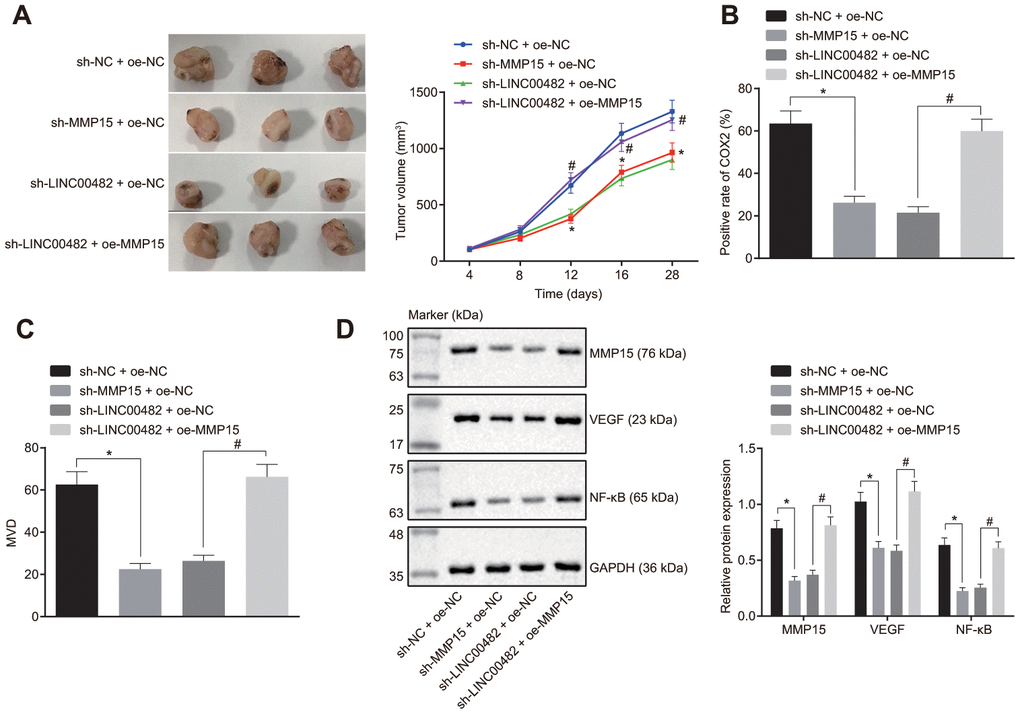 Silencing LINC00482 suppresses progression of bladder cancer in vivo. (A) Tumor volume in each group after injection of sh-MMP15, sh-LINC00482 and oe-MMP15; (B) immunohistochemistry of COX-2; (C) immunohistochemistry of MVD; (D) the expression of MMP15, VEGF, and NF-κB detected by Western blot analysis. The measurement data were presented as mean ± standard deviations, n = 8. Differences between two groups were compared by unpaired t test. Repeated measurement analysis of variance was used to compare the proliferation ability at different time points, and Tukey’s was used for post-hoc tests. * p vs. the sh-NC + oe-NC group; # p vs. the sh-LINC00482 + oe-NC group.