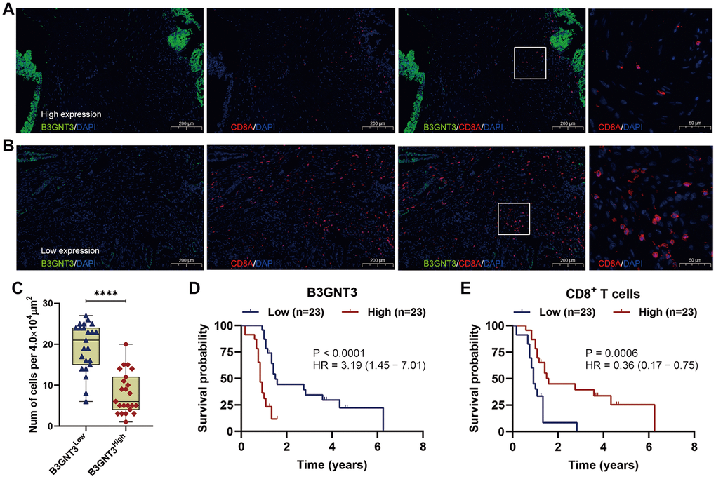 Multi-color immunofluorescence to investigate the relationship between B3GNT3 expression and CD8+ T cells infiltration in PC. (A) High B3GNT3 expression in multi-color immunofluorescence. (B) Low B3GNT3 expression in multi-color immunofluorescence. (C) High B3GNT3 expression group displayed a significant increased CD8+ T cells infiltration compared to low B3GNT3 expression group. (D) Patients with higher B3GNT3 expression had significant shorter OS that those with lower B3GNT3 expression. (E) Patients with higher CD8+ T cells infiltration had superior OS than those with lower CD8+ T cells infiltration.