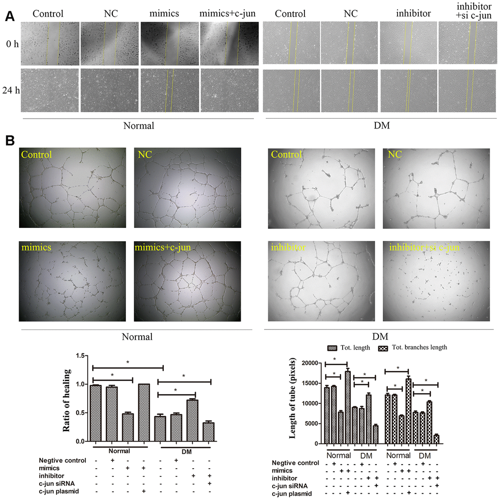 MiR-139-5p-mediated c-jun expression regulates the function of ECFCs. The migration (A) and angiogenesis (B) of normal ECFCs were co-transfected with miR-139-5p mimics and c-jun plasmids and diabetic ECFCs were co-transfected with miR-139-5p inhibitors and c-jun siRNA. The photos were captured by a 40X fluorescence microscope. (N=3) *P 