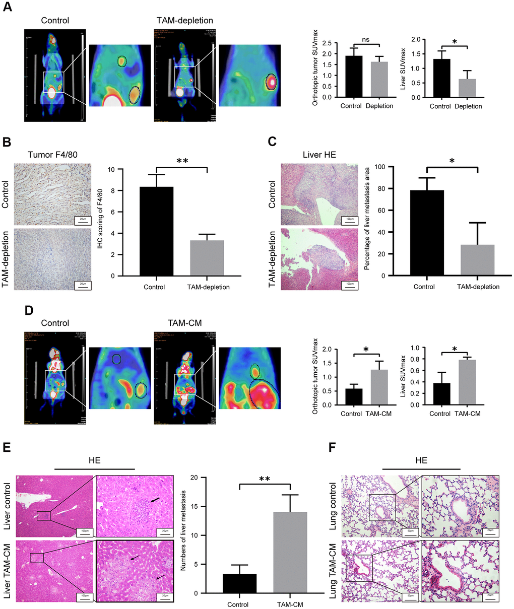 TAMs promote in vivo liver metastasis in the orthotopic PDAC tumor model mice. (A) Positron emission tomography/computed tomography (PET/CT) scanning images show primary pancreatic tumor and liver metastatic lesions in control and TAM-depletion group mice treated with clodronate-liposomes (CLDs). Note: n=6, *P B) IHC staining analysis shows expression of F4/80 in the primary PDAC tumor tissues from the control and TAM-depletion group mice. Scale bar = 20 μm; **P C) Representative images show H&E staining analyses of metastatic lesions in the liver sections from control and TAM-depletion group mice treated with clodronate-liposomes (CLDs). Scale bar = 100 μm, *P D) PET/CT scanning images show primary PDAC tumor and liver metastatic lesions in the control and TAM-CM treatment group mice. Note: n = 6; *P E) Representative images show H&E staining analyses of metastatic lesions in the liver tissues from control and TAM-CM treatment group mice. Scale bar = 20 μm; **P F) Representative images show H&E staining analyses of lung tissues from the control and TAM-CM group mice. Scale bar = 50 μm.