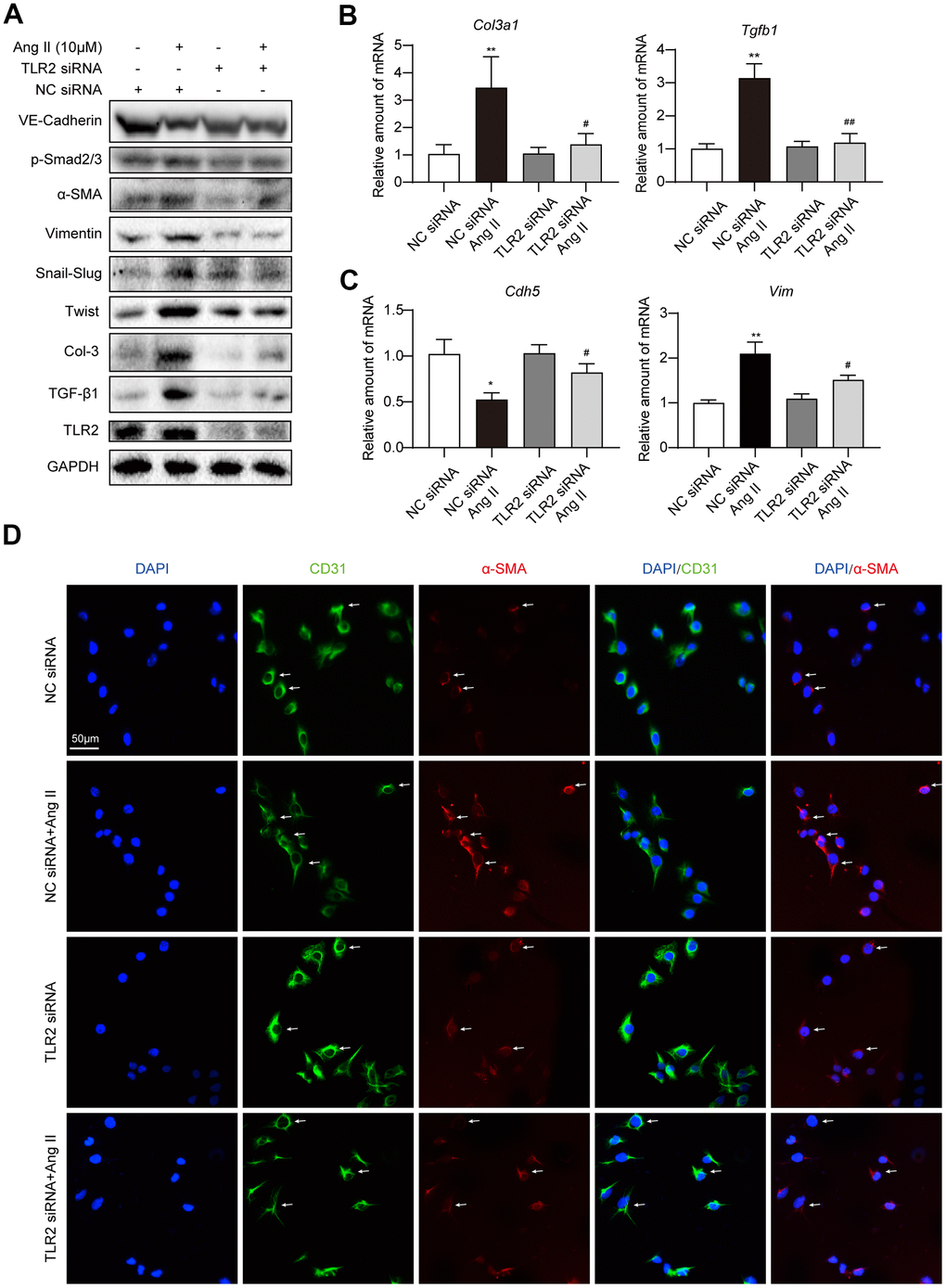 Silencing TLR2 prevents EndMT phenotype in cultured endothelial cells. (A) HUVECs were transfected with siRNA against TLR2. Control cells were transfected with negative control (NC) siRNA. Cells were then challenged with 10 μM Ang II for 36 h. Total proteins were probed for TLR2 and EndMT-associated proteins. GAPDH was used as loading control. (B, C) HUVECs were exposed to 10 μM Ang II for 24 h, after siRNA transfections. mRNA levels of EndMT-associated genes were determined. Data was normalized to β-actin. (D) Representative immunofluorescence staining of HUVECs for CD31 (green) and α-SMA (red). Cells were transfected with indicated siRNA and then exposed to 10 μM Ang II for 36 h. Slides were counterstained with DAPI (blue). Arrows indicate HUVECs undergoing EndMT, as evident through loss of CD31 and induction of α-SMA [Scale bar = 50 μm]. [n = 3; Data shown as Mean ± SEM; *p