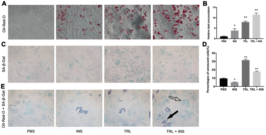 Postprandial TRL induced both adipogenesis and premature senescence in AMSCs. (A) AMSCs were treated with PBS, 10 μg/mL INS alone, 100 μg/mL TRL alone, or 100 μg/mL TRL + 10 μg/mL INS for 8 d after 48h confluence and then stained by Oil-Red-O. Images were obtained under a microscope (×200 magnification). (B) Quantification of relative lipid accumulation was measured for absorbance at 520 nm. (C) SA-β-Gal was performed to detect senescent cells. Images were obtained under a microscope (×200 magnification). (D) SA-β-Gal positive cells were counted manually by scanning a total of 200 cells in each sample. (E) SA-β-Gal positive cells were found in both undifferentiated (only blue SA-β-Gal in the cytoplasm, marked by a hollow arrow) and differentiating (both blue SA-β-Gal and red lipid droplets in the cytoplasm, marked by a solid arrow) AMSCs. Images were obtained under a microscope (×400 magnification). Data are expressed as mean ± SD (n ≥ 3). *P **P 