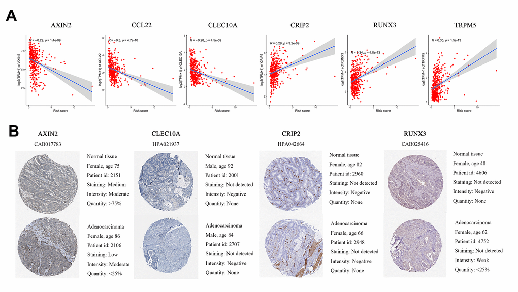 Differences in protein expression induced by six genes were verified in human tissue samples. (A) Pearson correlation of expression and risk score in GEO. (B) Representative immunohistochemical staining images of four genes in normal colon tissue and colon cancer specimen.