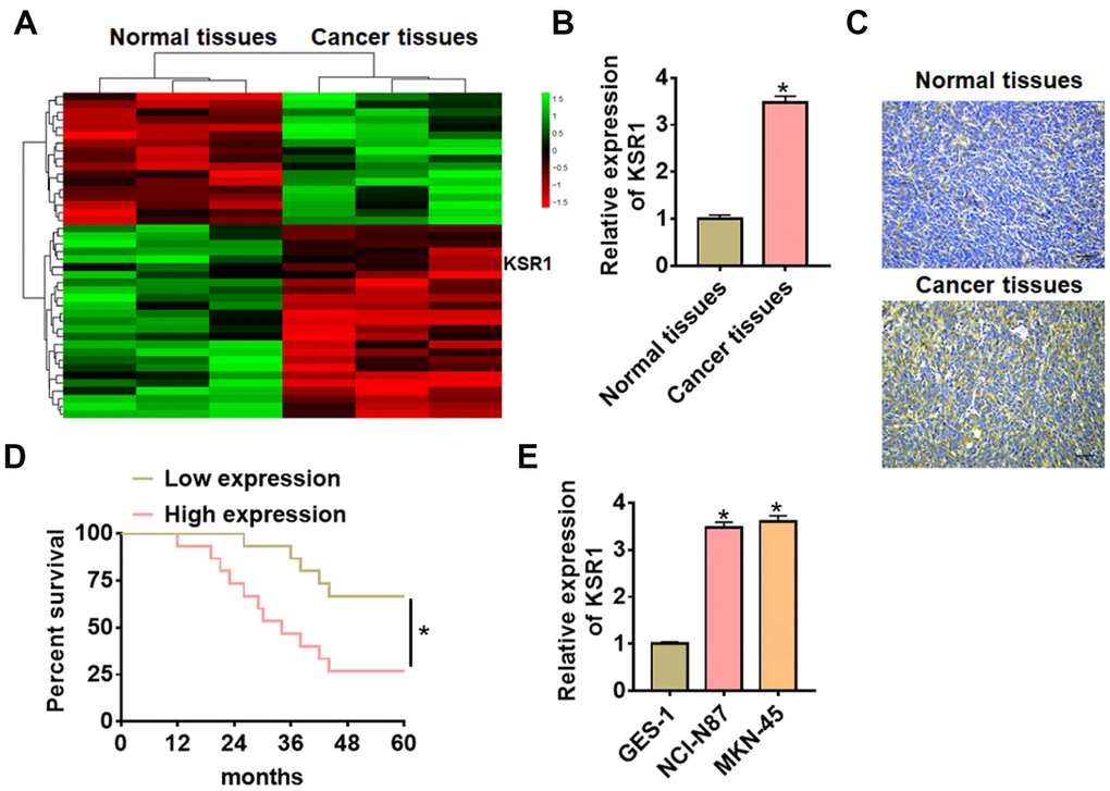 The expression of KSR1 in GC tissues and cell lines. (A) mRNA expression profiles of normal tissues and cancer tissues in GC. (B) The expression of KSR1 in normal and cancer tissues was detected by qRT-PCR. n = 40. (C) IHC for KSR1 in normal and cancer tissues of GC. Scale bar, 40 μm. (D) According to the median level of KSR1 in Figure 1B, 40 GC patients were divided into low (n = 20) and high expression group (n = 20). Kaplan-Meier curves indicated a 5-year survival rate of GC patients. (E) qRT-PCR analysis for KSR1 level in normal gastric mucosal epithelial cell line GES-1 and GC cell lines (NCI-N87, MKN-45). Data are mean ± SD; *P 