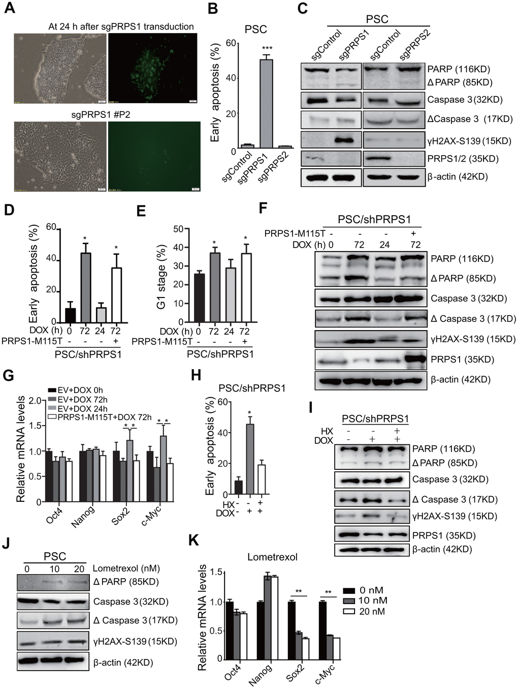PRPS1 is critical for PSCs survival and stemness by controlling purine synthesis. (A) Representative images of cells at 24 h post sgRNA-PRPS1 lentivirus infection or at second passage (P2). Bars: 20 μm. (B) FACS analysis of cell apoptosis in PSCs at Day 3 after sgPRPS1 or sgPRPS2 lentivirus transduction. *** PC) WB of the expression of DNA damage and apoptosis marker proteins in the PSCs from (B). (D, E) FACS analysis of cell apoptosis (D) and cell cycle (E) in DOX-induced PRPS1 KD PSCs with or without ectopic expression of PRPS1 M115T mutant. DOX was added for 0h, 72h, or 24 h to induce PRPS1 KD. At 24 h, DOX were removed to rescue PRPS1 expression. PRPS1-M115T mutant, an enzymatically inactive PRPS1 mutant. (F) WB of the expression of DNA damage and apoptosis marker proteins in the PSCs from (D). (G) qRT-PCR analysis of the expression levels of pluripotency genes in the PSCs from (D). (H) FACS analysis of cell apoptosis in response to HX treatment based on PRPS1 KD. (I) WB of the expression of DNA damage and apoptosis marker proteins in response to HX treatment based on PRPS1 KD. (J) WB of the expression of DNA damage and apoptosis marker proteins in response to Gart inhibitor, lometrexol, treatment. (K) qRT-PCR analysis of the expression levels of pluripotency genes in the PSCs from (J). In (B, D, E, G, H and K), data are expressed as the mean ± SD. *P P t-test. Data are representative of three independent experiments with similar results.