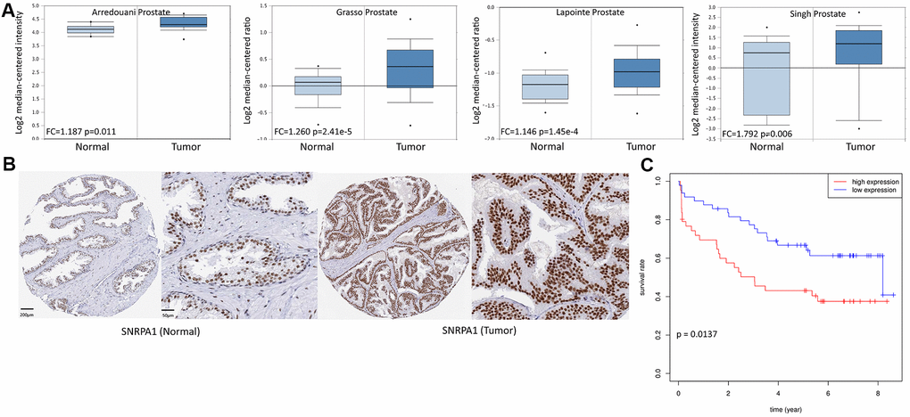 External validation of SNRPA1 in multiple databases. (A) SNRPA1 expression between PCa and normal samples in four studies of Oncomine. (B) The immunohistochemical results of SNRPA1 in HPA. (C) The prognostic profile of SNRPA1 with DFS in an independent external cohort GSE70769. PCa: Prostate cancer; HPA: Human Protein Atlas; DFS: disease-free survival; N: normal sample; T: tumor sample.
