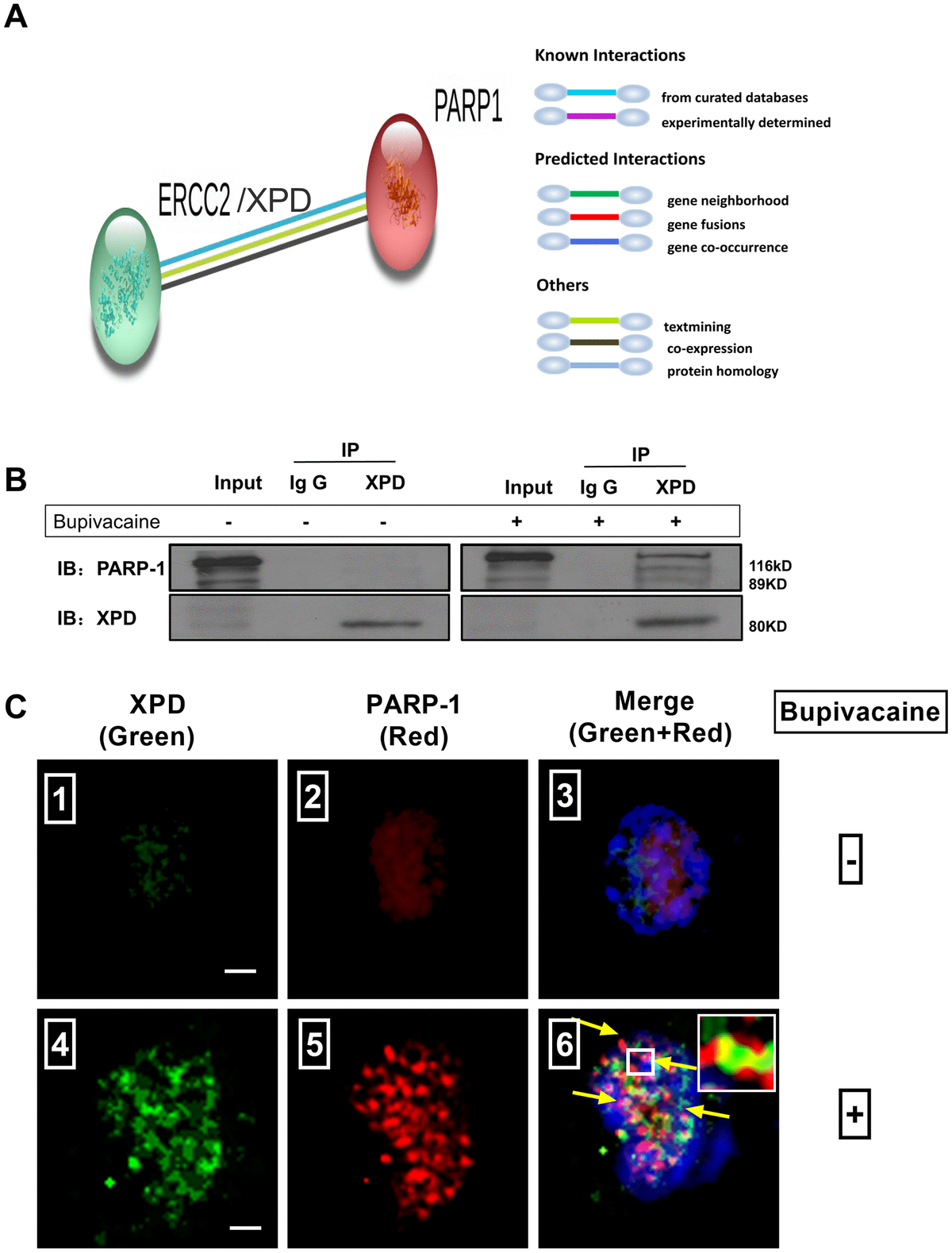 The Roles Of Parp And Xpd And Their Potential Interplay In Repairing Bupivacaine Induced