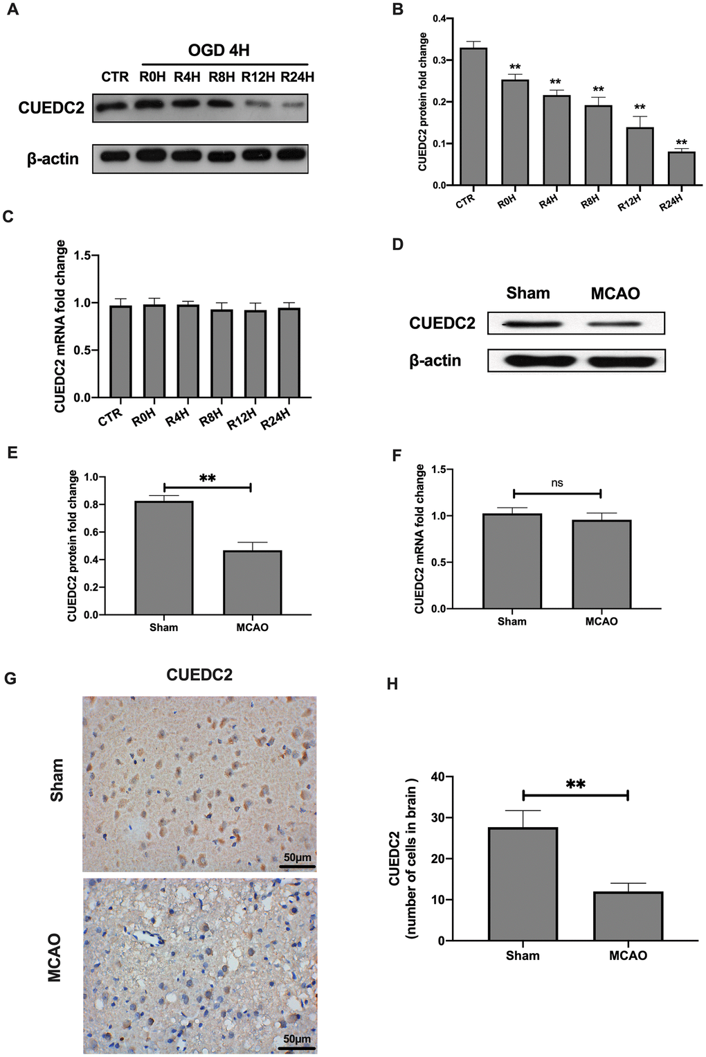 Cerebral I/R induced the downregulation of CUEDC2 expression in brain tissues. (A–C) Protein and mRNA expression of CUEDC2 in neurons as detected by western blotting and PCR assays. (D–F) Protein and mRNA expression of CUEDC2 in brain tissues as assayed by western blotting and PCR. (G, H) Protein expression of CUEDC2 in brain tissues as assayed by immunohistochemical staining. Scale bar = 50 μm. CTR, control; CUEDC2: CUE domain-containing 2; OGD/R: oxygen-glucose deprivation (4 hours) and reperfusion (0,4,8,12, and 24 hours); MCAO, middle cerebral artery occlusion. All data are presented as the mean value ± SD. *p