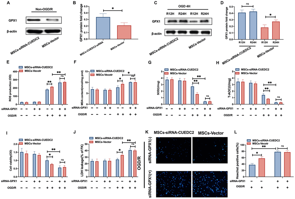 CUEDC2 silencing in MSCs upregulates the antioxidant effect on co-cultured neurons by increasing GPX1 expression. (A, B) GPX1 protein expression in co-cultured neurons under non-OGD/R condition as detected by western blotting. (C, D) GPX1 protein expression in co-cultured neurons under OGD/R condition as detected by western blotting. (E) ROS production in co-cultured neurons after treatment with various MSCs as analyzed by DCFH-DA assay. (F) MDA production in co-cultured neurons after treatment with various MSCs as evaluated by lipid peroxidation MDA assay. (G) SOD production in co-cultured neurons after treatment with various MSCs as determined by WST-8 assay. (H) T-AOC level in co-cultured neurons after treatment with various MSCs as detected by ABTS assay. (I) Viability of co-cultured neurons after treatment with various MSCs as evaluated by MTT analysis. (J) Apoptosis in co-cultured neurons after treatment with various MSCs as evaluated by LDH leakage assay. (K, L) Apoptosis in co-cultured neurons after treatment with various MSCs as detected by Hoechst staining. CUEDC2: CUE domain-containing 2; OGD/R: oxygen-glucose deprivation (4 hours) and reperfusion (12- or 24-hours). MSCs-siRNA-CUEDC2: small interfering RNA silencing CUEDC2 in MSCs; MSCs-vector: the vector of MSCs; siRNA-GPX1: small interfering RNA knockdown of GPX1 in MSC; All data are presented as the mean value ± SD. *p